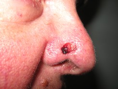 Nose