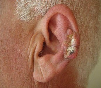 Ear