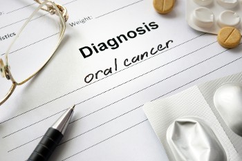 Diagnosis: Oral Cancer